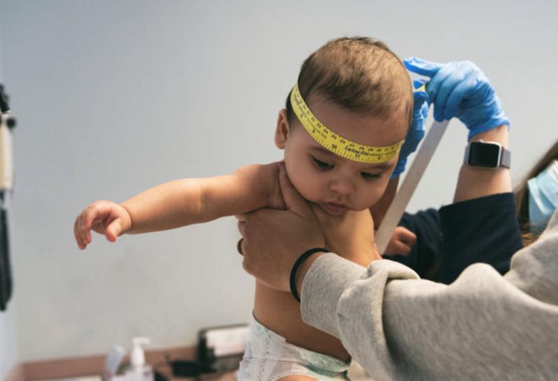 a doctor measuring the circumference of a babys head